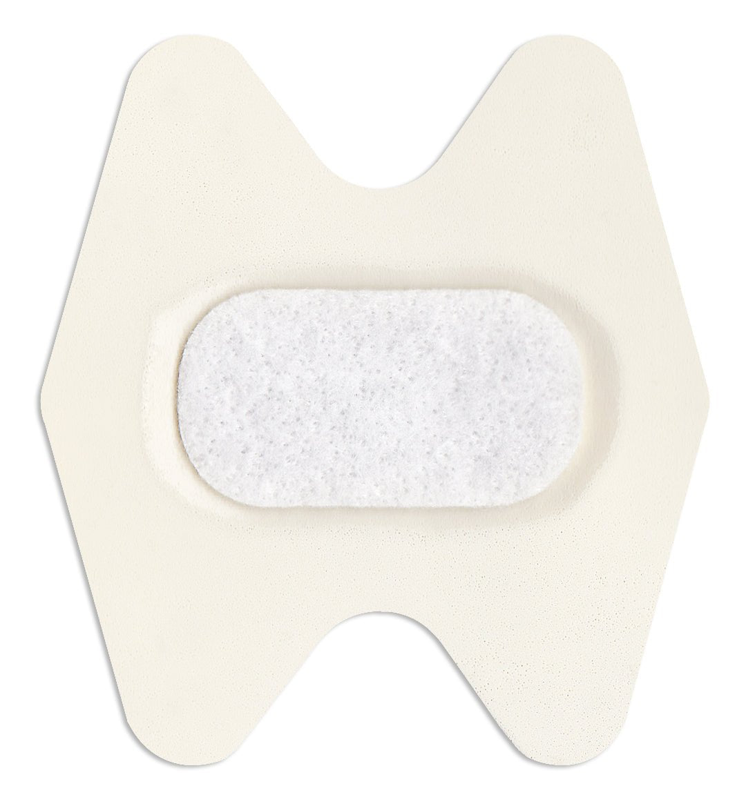 Pro Advantage® Gentle Stim Iontophoresis Electrode Treatment Kit - Cornish Medical